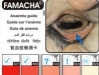 FAMACHA Workshop at Alfred State College