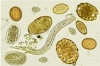 Fecal Egg Count Mobile Workshop - Ellicottville