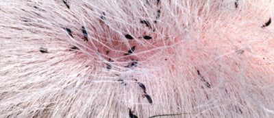 Dealing with Lice on our Ruminant Species